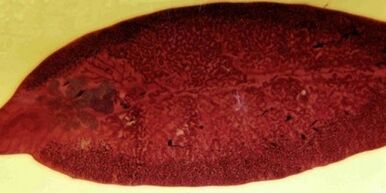 trematode parasiet hoe te verwijderen uit het lichaam